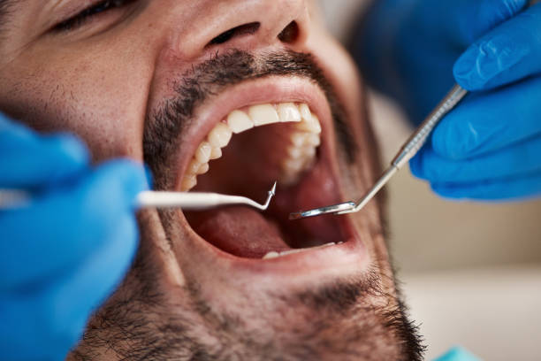 Best Emergency Treatment for Dental Infections or Abscesses in Campbellsport, WI