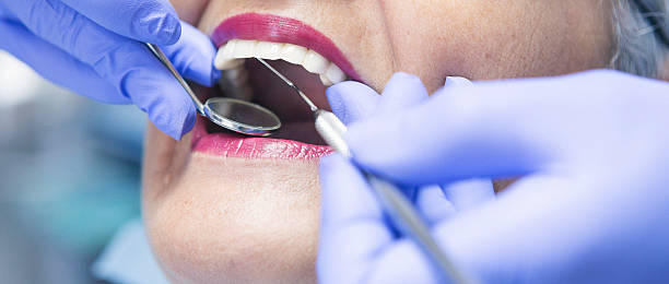 Best Emergency Tooth Extraction in Campbellsport, WI